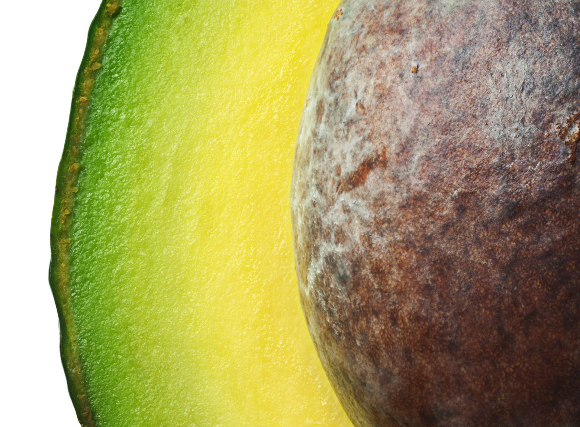 An Avocado Allergy? Yes, It’s possible!