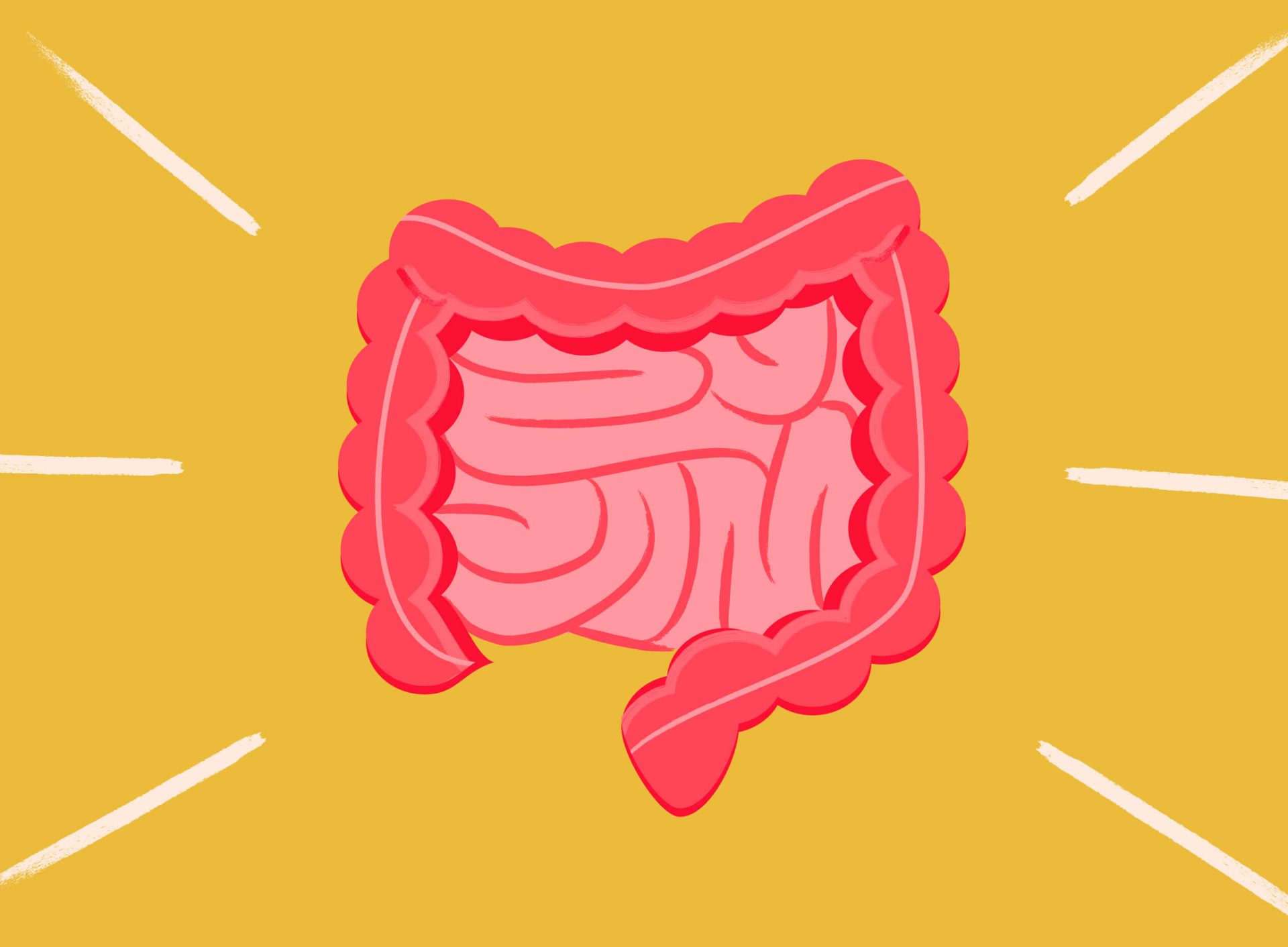 Le syndrome de l'intestin perméable